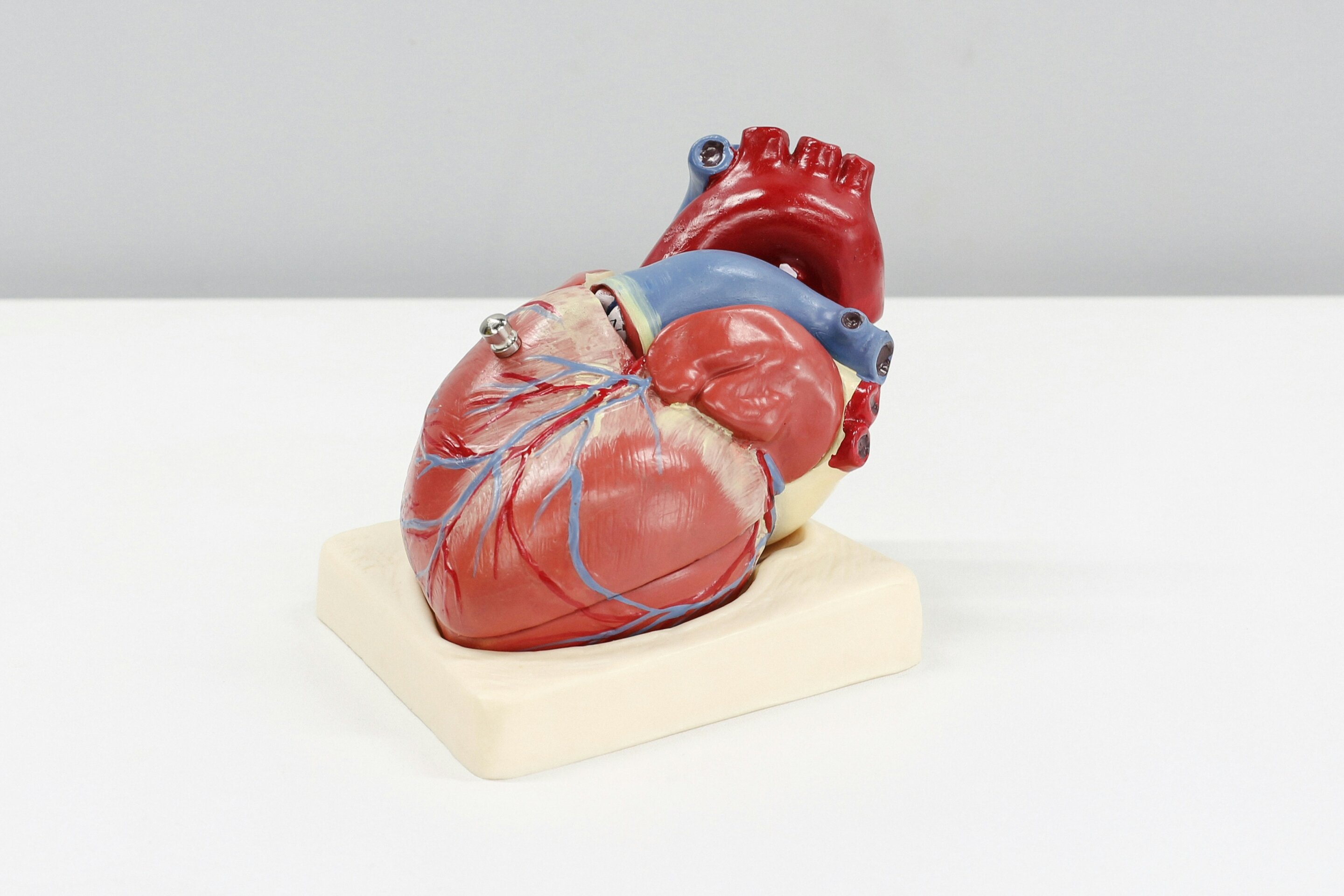 Newly Identified 'Lemon-on-Sticks' Phenotype Signals Poor Prognosis in Heart Failure Patients