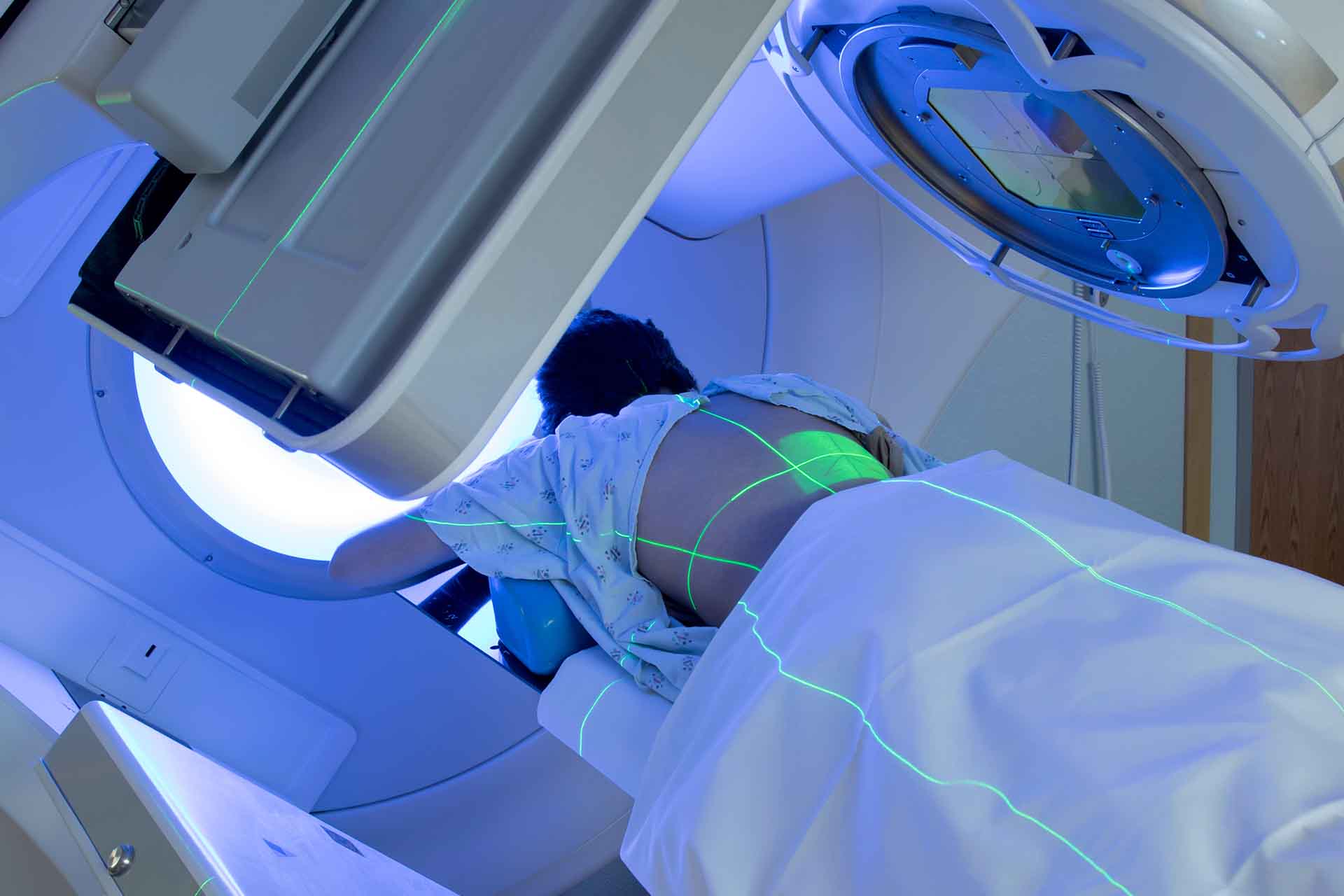 Deadly Side Effect Revealed: Proton Therapy vs Photon Therapy for Throat Cancer Patients