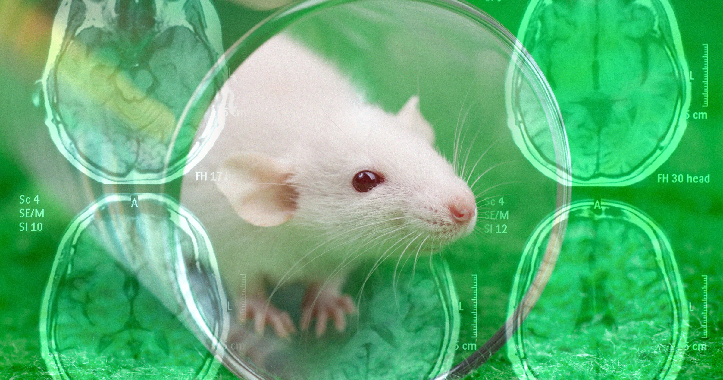 Breakthrough Nanotech Reverses Alzheimer's in Mice — Human Trials Next?