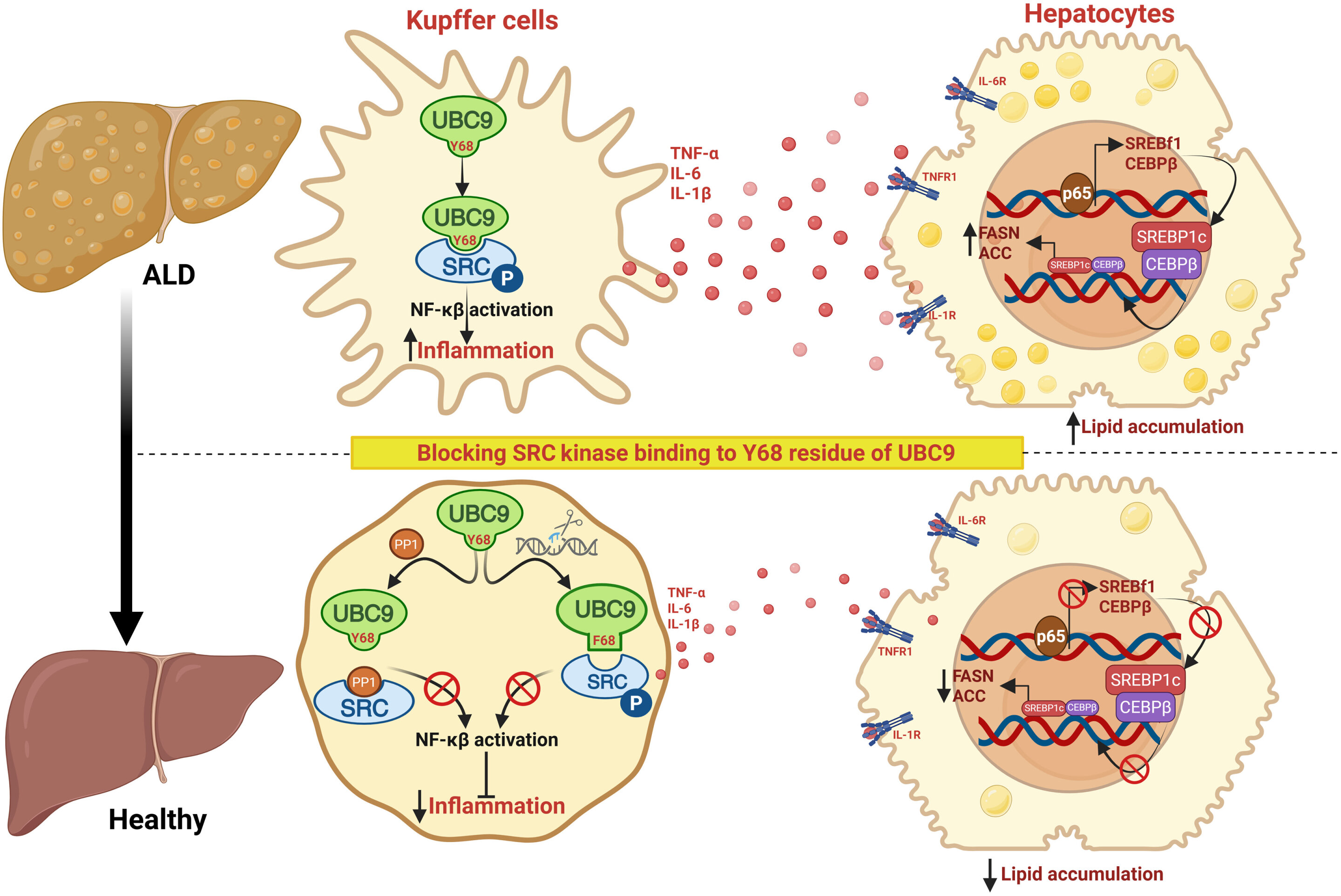 Breakthrough in Alcohol Associated Liver Disease: Researchers Uncover Molecular Triggers of Inflammation