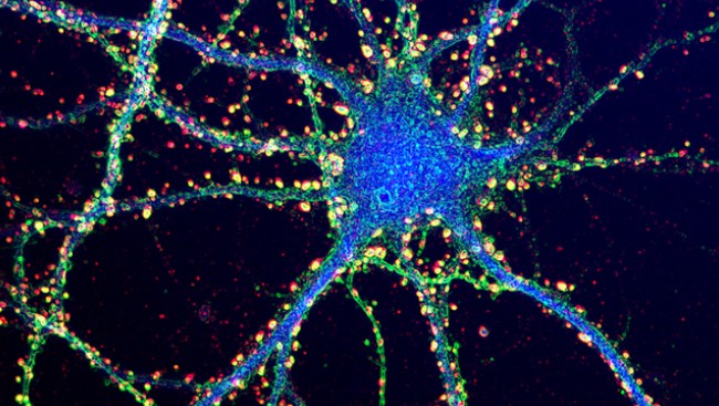 Neuroscientists Identify Brain Circuit That Translates Goals Into Physical Action