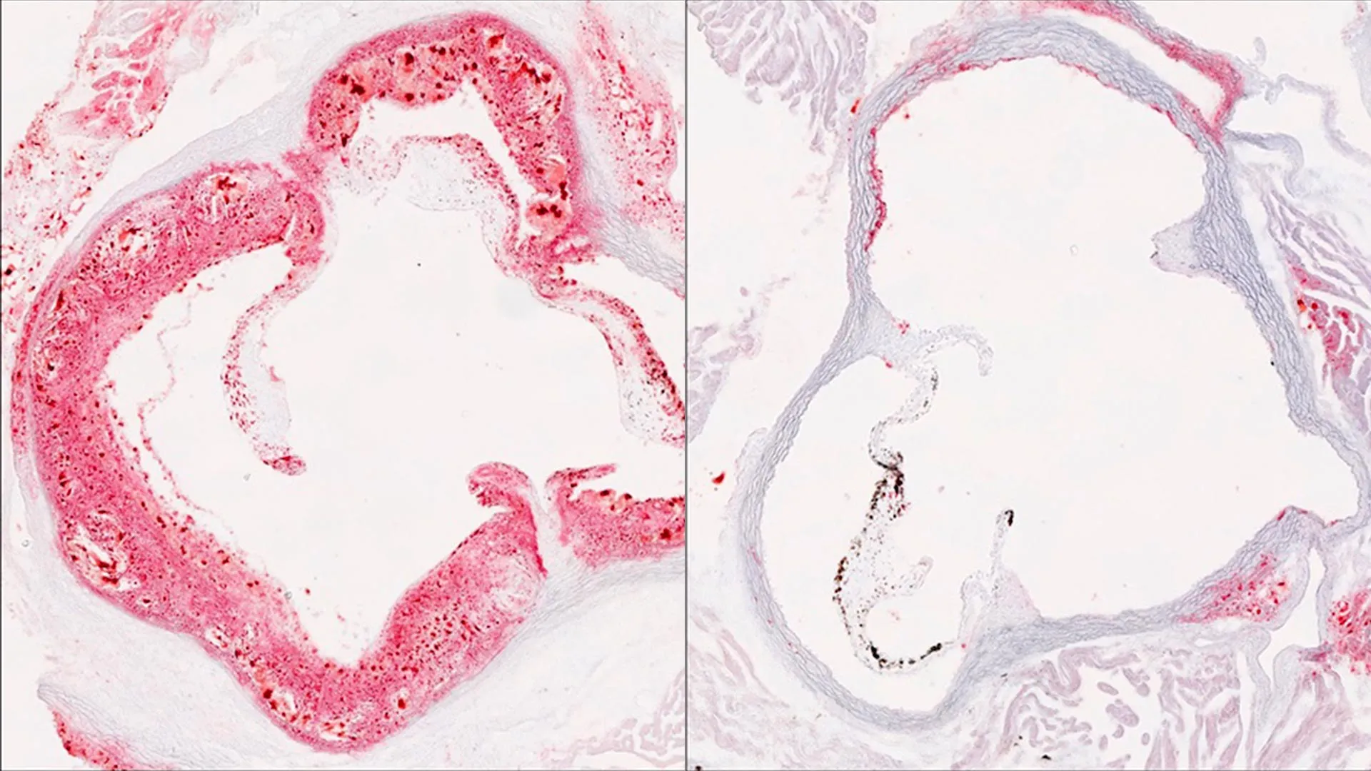 Breakthrough Discovery: Scientists Identify Liver Protein That Could Transform Cholesterol Management