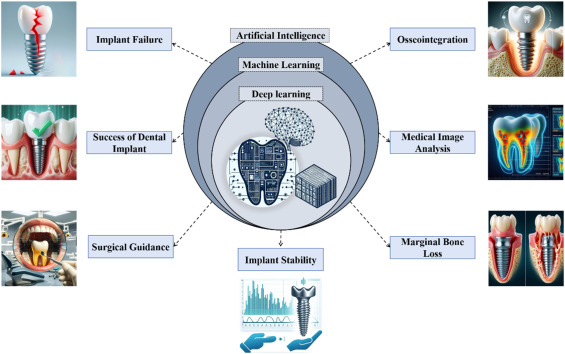 How Machine Learning Is Revolutionizing Titanium Implant Manufacturing for Medical Use