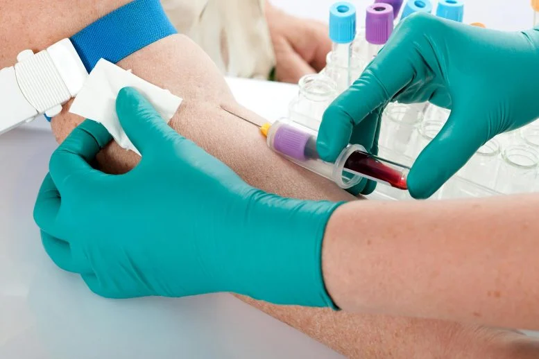 Breakthrough Blood Test May Eliminate Invasive Biopsies for Lung Transplant Patients
