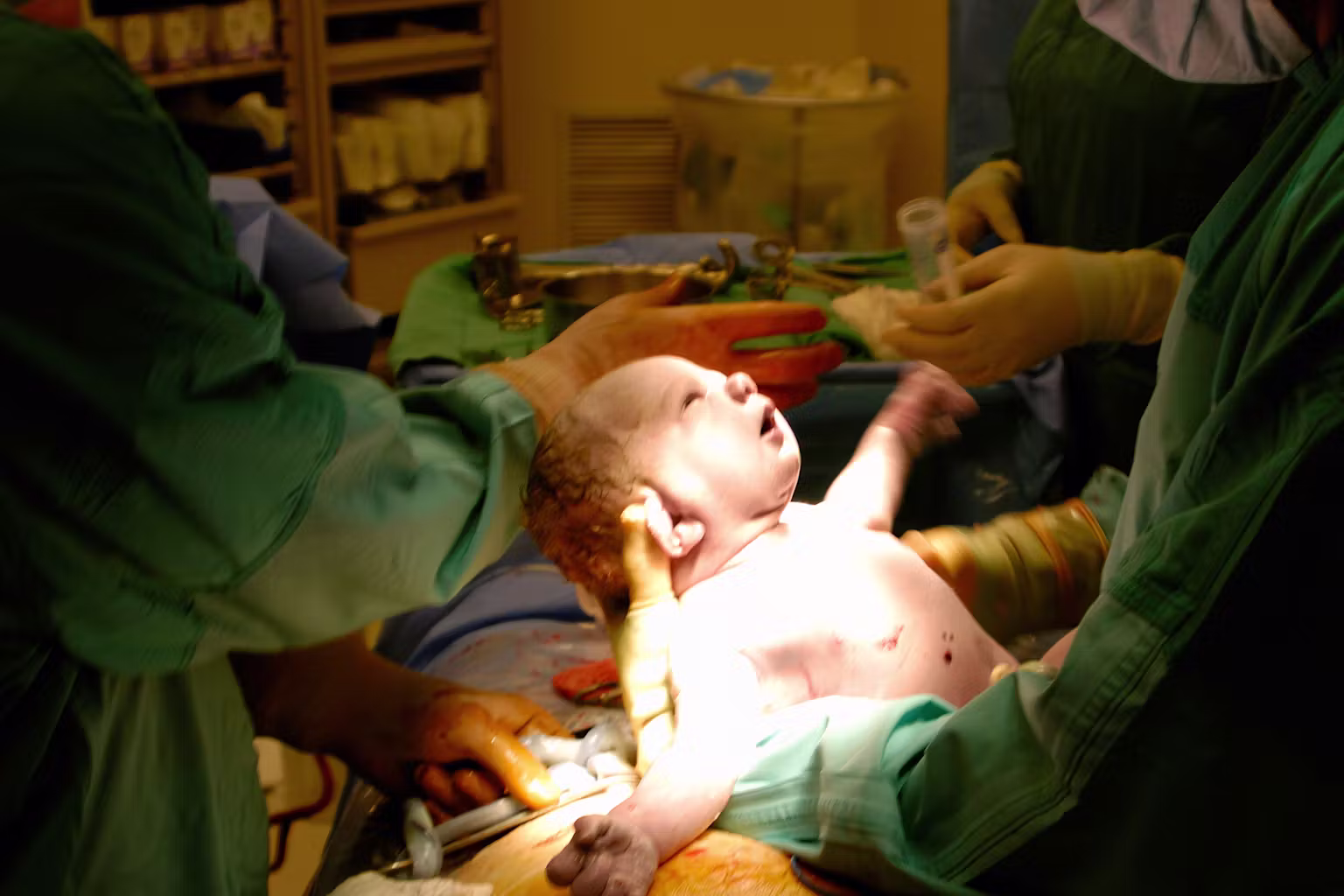Emergency Caesarean Rates in England Surge to One in Four Births: What’s Driving the Shift?