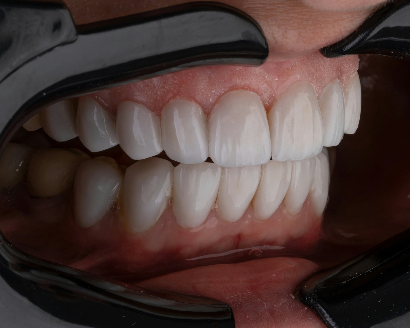 Scientists Explore the Possibility of Regrowing a Third Set of Teeth: What Research Reveals
