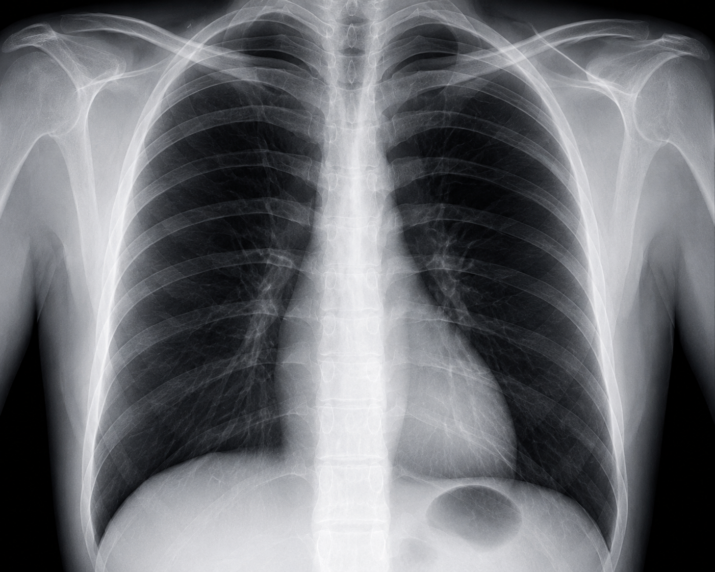 FDA Fast Tracks Generative AI Tools for Radiology: A Breakthrough in Diagnostic Efficiency